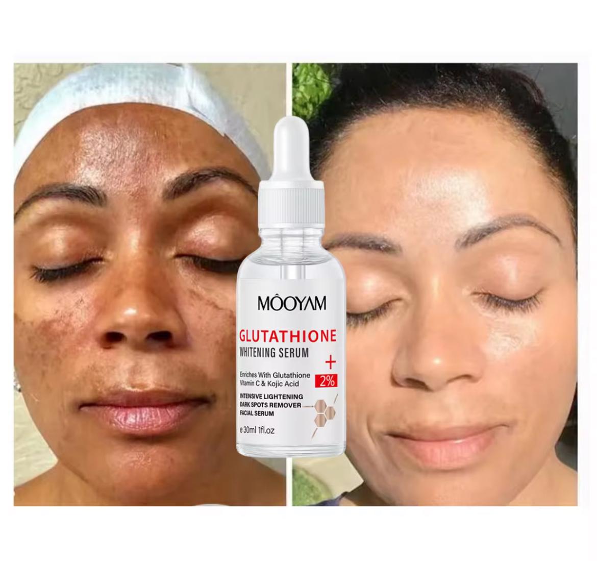 Glutathione Whitening Serum With VitaminC & Kojic Acid