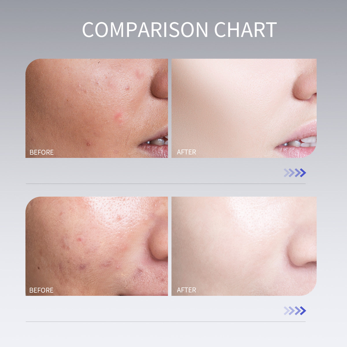 Korean Skin Care Anti-aging Astaxanthin Serum