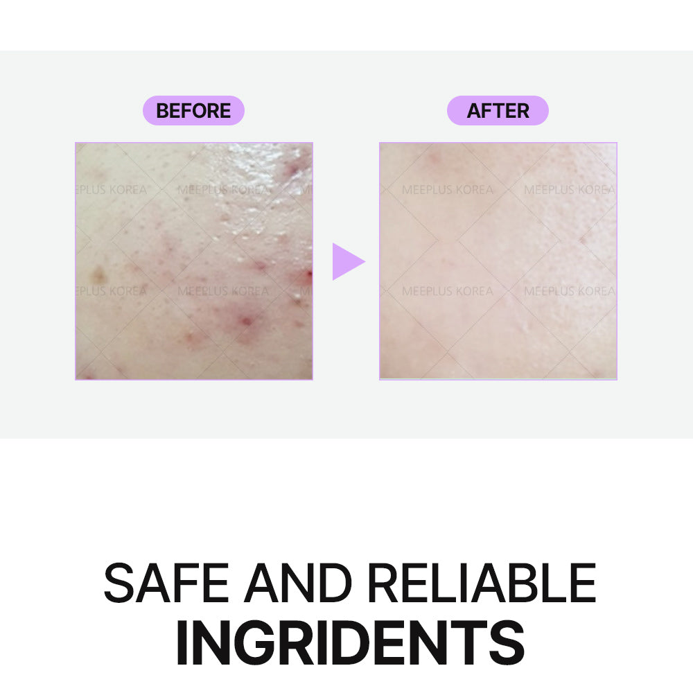 Acne Clear Control, Pure Vita Plus Ampoule- Dr. Drawing (korea Labs)