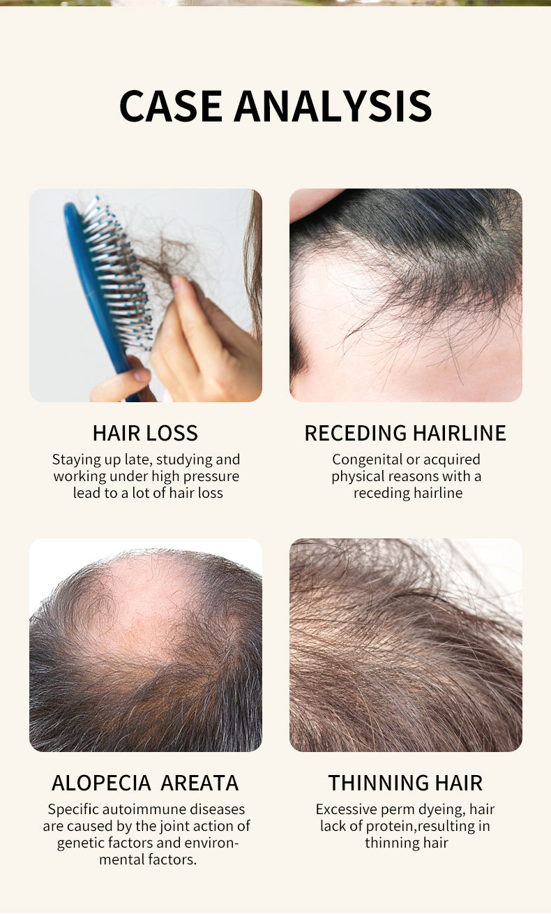 100% Natural Rosemary Castor Oil -Hair Treatment Scalp Care Serum Hair Growth Oil Elixir